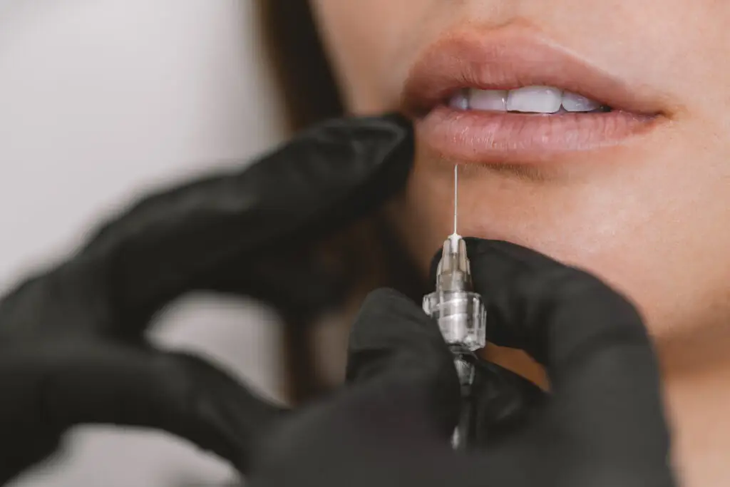 dermal fillers 101