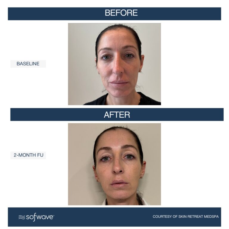 Set-101-Lower-Face-Eyebrows