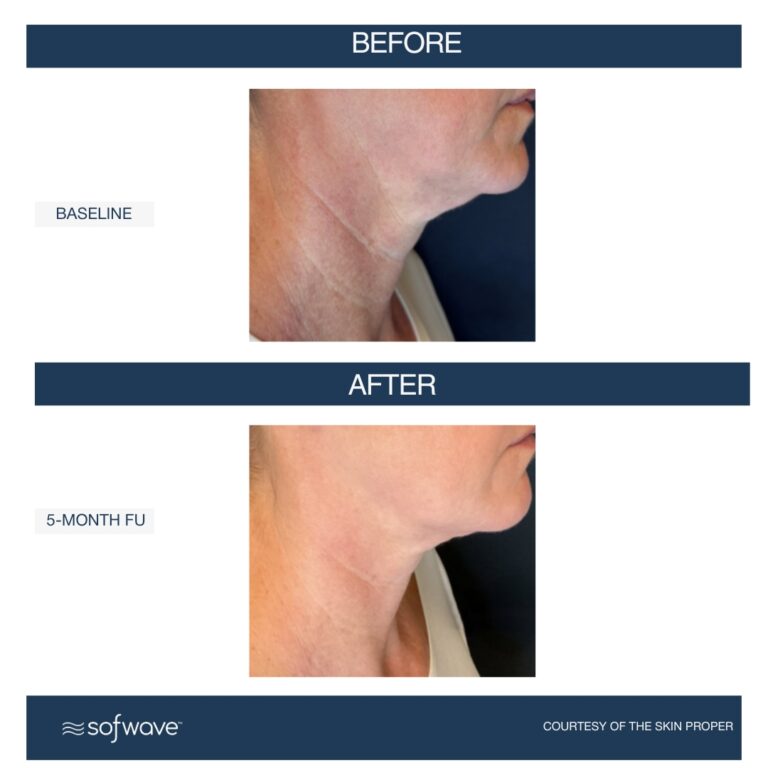 Set-106-Lower-Face-Neck