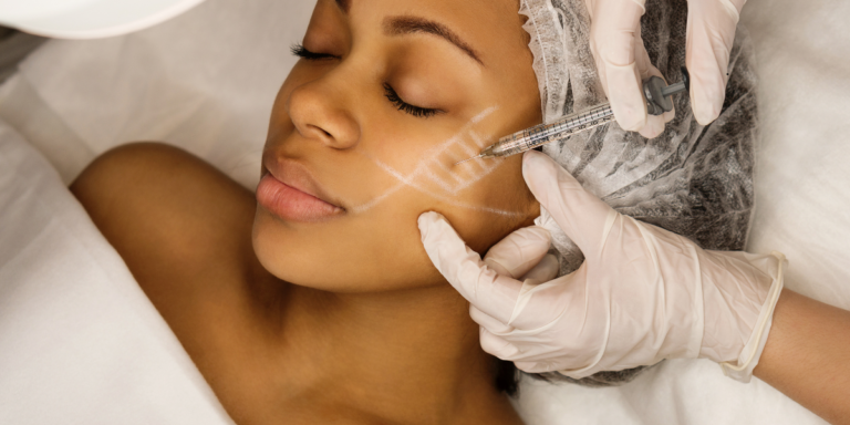 How Sculptra Works in the Skin