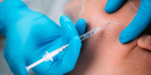 How long Sculptra jawline results last and what maintenance looks like